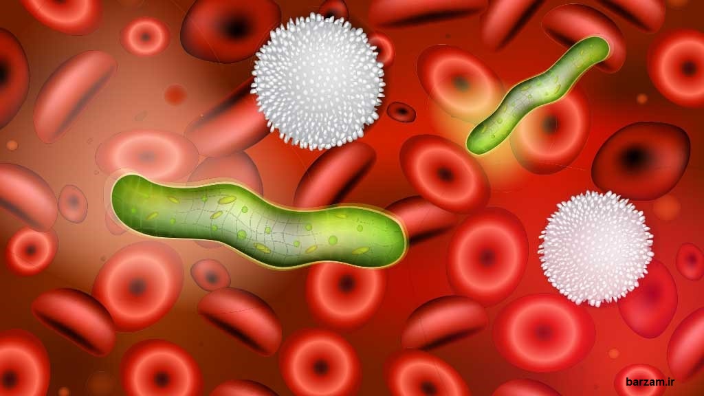 سپسیس یا عفونت خون چیست؟